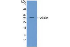 Figure. (Coxsackie Adenovirus Receptor 抗体  (AA 20-229))
