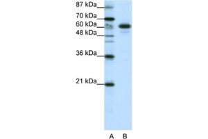 Western Blotting (WB) image for anti-Cas-Br-M (Murine) Ecotropic Retroviral Transforming Sequence-Like 1 (CBLL1) antibody (ABIN2461939) (CBLL1 抗体)