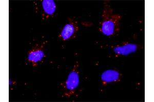 Proximity Ligation Analysis of protein-protein interactions between STAT1 and PTK2.