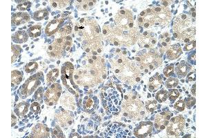 PPIE antibody was used for immunohistochemistry at a concentration of 4-8 ug/ml to stain Epithelial cells of renal tubule (arrows) in Human Kidney. (PPIE 抗体)