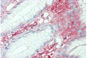 Immunohistochemistry (IHC) image for anti-Solute Carrier Family 7 (Cationic Amino Acid Transporter, Y+ System), Member 2 (SLC7A2) (Internal Region) antibody (ABIN1049350)