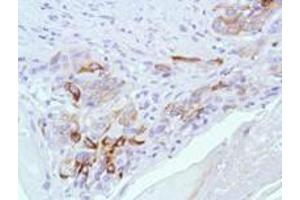 Immunohistochemistry (IHC) image for anti-BCL2-Associated X Protein (BAX) (Internal Region) antibody (ABIN6655295)