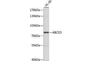 Western blot analysis of extracts of HL-60 cells, using  antibody (ABIN6134210, ABIN6136382, ABIN6136383 and ABIN6224696) at 1:1000 dilution. (ABCG5 抗体  (AA 350-450))