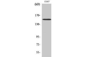 Western Blotting (WB) image for anti-phospholipase C, gamma 1 (PLCG1) (pTyr771) antibody (ABIN3173207) (Phospholipase C gamma 1 抗体  (pTyr771))