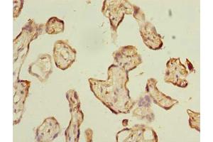 Immunohistochemistry of paraffin-embedded human placenta tissue using ABIN7142924 at dilution of 1:100 (ABI3 抗体  (AA 1-366))