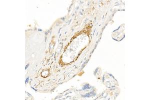Immunohistochemistry of paraffin-embedded human placenta using TAGLN Rabbit pAb (ABIN6128763, ABIN6148829, ABIN6148830 and ABIN6222495) at dilution of 1:25 (40x lens). (Transgelin 抗体  (AA 1-201))