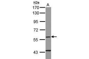 Image no. 1 for anti-Cytochrome P450, Family 4, Subfamily F, Polypeptide 11 (CYP4F11) (AA 1-235) antibody (ABIN1497739) (CYP4F11 抗体  (AA 1-235))