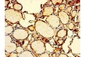 Immunohistochemistry of paraffin-embedded human thyroid tissue using ABIN7151974 at dilution of 1:100 (EDEM2 抗体  (AA 22-300))