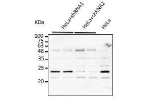Anti-Rab7a Ab at 1/2,500 dilution, HeLa cells transduced with Ad Rab7a shRNA, Iysates at 50 µg per Iane, rabbit polyclonal to goat IgC (HRP) at 1/10,000 dilution,