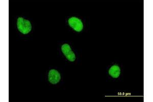 Immunofluorescence of purified MaxPab antibody to UBE2S on HeLa cell. (UBE2S 抗体  (AA 1-222))