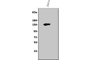 Western blot analysis of Thrombospondin/THBS1 using anti-Thrombospondin/THBS1 antibody (ABIN7600407).