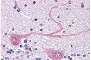 Human Brain, Cerebellum (formalin-fixed, paraffin-embedded) stained with ARMET antibody ABIN343894 at 5 ug/ml followed by biotinylated goat anti-rabbit IgG secondary antibody ABIN481713, alkaline phosphatase-streptavidin and chromogen. (MANF 抗体  (C-Term))