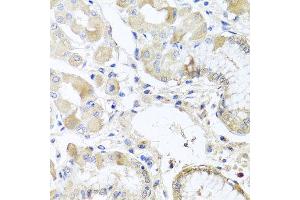 Immunohistochemistry of paraffin-embedded human gastric using RPL36 antibody at dilution of 1:100 (x40 lens). (RPL36 抗体)