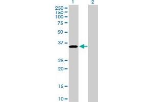 Western Blot analysis of PROCR expression in transfected 293T cell line by PROCR MaxPab polyclonal antibody. (PROCR 抗体  (AA 1-238))