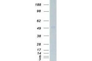 Western Blotting (WB) image for Complement Component 3a Receptor 1 (C3AR1) protein (Myc-DYKDDDDK Tag) (ABIN2715508)