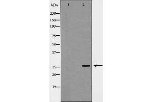 Western blot analysis of extracts of mouse liver, using C1QB antibody. (C1QB 抗体  (Internal Region))