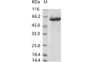 Western Blotting (WB) image for Zika Virus NS5 (ZIKV NS5) protein (His tag) (ABIN7198758) (ZIKV NS5 Protein (His tag))
