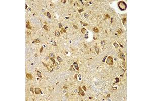 Immunohistochemistry of paraffin-embedded mouse brain using SMAD9 antibody (ABIN5975592) at dilution of 1/100 (40x lens). (SMAD9 抗体)