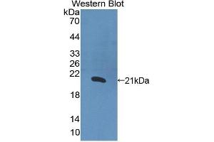 Detection of Recombinant IL1a, Human using Polyclonal Antibody to Interleukin 1 Alpha (IL1a) (IL1A 抗体  (AA 113-271))
