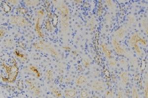 ABIN6275435 at 1/100 staining Human lymph node tissue by IHC-P. (RAB3GAP1 抗体  (Internal Region))