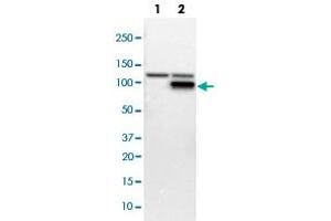 Western blot analysis of Lane 1: NIH-3T3 cell lysate (Mouse embryonic fibroblast cells); Lane 2: NBT-II cell lysate (Rat Wistar bladder tumour cells) with PFKM polyclonal antibody  at 1:100-1:250 dilution. (PFKM 抗体)