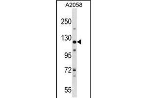 Western blot analysis in A2058 cell line lysates (35ug/lane). (BAT3 抗体  (C-Term))