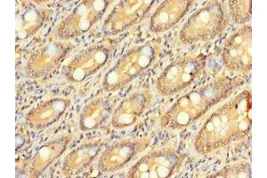 Immunohistochemistry of paraffin-embedded human small intestine tissue using ABIN7176385 at dilution of 1:100 (ZNF562 抗体  (AA 201-426))