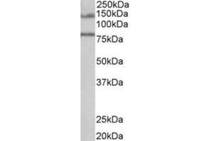 AP31721PU-N EPB41L5 antibody staining of Human Brain (Hippocampus) lysate at 1 µg/ml (35 µg protein in RIPA buffer). (EPB41L5 抗体  (Internal Region))