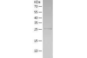 Western Blotting (WB) image for Aldo-keto Reductase Family 1, Member C2 (AKR1C2) (AA 1-256) protein (His tag) (ABIN7286444) (AKR1C2 Protein (AA 1-256) (His tag))