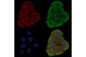 ABIN6262527 and ABIN6278482 staining Hela cells(30 min of UV treatment) by IF/ICC. (IL32 抗体  (Internal Region))