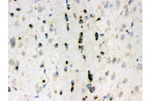 Anti- Lumican Picoband antibody, IHC(P) IHC(P): Mouse Brain Tissue (LUM 抗体  (AA 68-338))