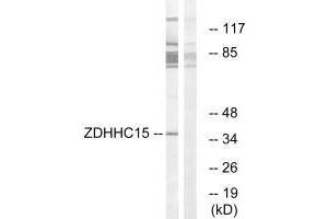 Western blot analysis of extracts from Jurkat cells, using ZDHHC15 antibody. (ZDHHC15 抗体  (C-Term))