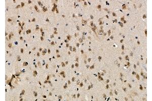 ABIN6263167 and ABIN6276541 at 1/100 staining Rat brain tissue by IHC-P.
