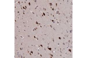 Immunohistochemical staining of human cerebral cortex with ADO polyclonal antibody  shows strong cytoplasmic positivity in neuronal cells. (ADO 抗体)