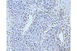 IHC analysis of KIFC1 using anti-KIFC1 antibody (ABIN7599523).