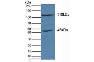 Detection of KIF18A in Human Hela Cells using Polyclonal Antibody to Kinesin Family, Member 18A (KIF18A) (KIF18A 抗体  (AA 1-453))