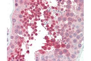 Anti-YBX3 / CSDA antibody IHC staining of human testis. (CSDA 抗体  (AA 290-339))
