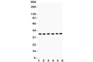 Western blot testing of Rad51 antibody and Lane 1:  22RV1;  2: SW620;  3: PANC;  4: U87;  5: CEM;  6: MM231. (RAD51 抗体  (AA 1-258))