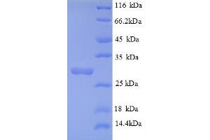 SDS-PAGE (SDS) image for Collagen, Type IV, alpha 3 (COL4A3) (AA 1446-1667), (partial) protein (His tag) (ABIN5709311) (COL4a3 Protein (AA 1446-1667, partial) (His tag))