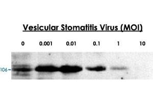 24-hour post infection immunoblots of whole cell lysates from primary murine microglia cells (2x10 6 ) untreated (0) or exposed to vesicular stomatitis virus at a range of viral particle/cell ratios. (DDX58 抗体  (C-Term))