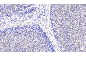 Detection of IL6R in Human Lymph node Tissue using Polyclonal Antibody to Interleukin 6 Receptor (IL6R) (IL-6 Receptor 抗体  (AA 216-356))