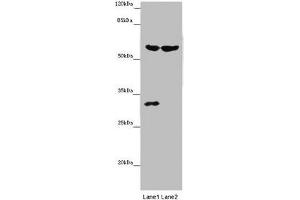 Western blot All lanes: TERF2 antibody at 14 μg/mL Lane 1: Mouse thymus tissue Lane 2: MCF-7 whole cell lysate Secondary Goat polyclonal to rabbit IgG at 1/10000 dilution Predicted band size: 60, 33 kDa Observed band size: 60, 31 kDa (TRF2 抗体  (AA 78-238))