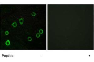 Immunofluorescence analysis of LoVo cells, using ADORA2A polyclonal antibody . (Adenosine A2a Receptor 抗体)