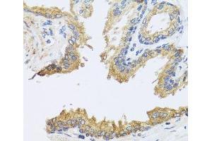 Immunohistochemistry of paraffin-embedded Human prostate using ARL6 Polyclonal Antibody at dilution of 1:100 (40x lens). (ARL6 抗体)