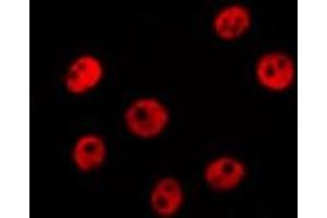 Immunofluorescence (fixed cells) (IF/ICC) image for anti-E74-Like Factor 5 (Ets Domain Transcription Factor) (ELF5) (Internal Region) antibody (ABIN6261512)