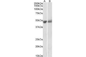ABIN2613477 (0. (PEDF 抗体  (Internal Region))