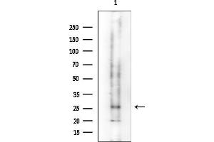 Western blot analysis of lysates from Mouse kidney, using DLX4 Mouse Monoclonal Antibody at 1/1000 dilution.