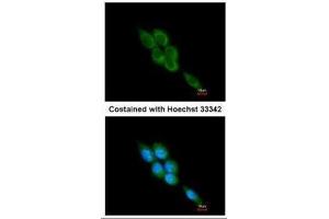 ICC/IF Image Immunofluorescence analysis of methanol-fixed A431, using Calpain 1, antibody at 1:200 dilution.