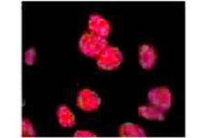 Anti-ATM Monoclonal Antibody - Immunofluorescence Anti ATM Antibody showing overlay of anti-ATM pS1981 staining. (ATM 抗体  (pSer1981) (HRP))