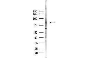 Western blot analysis of lysates from HepG2 cells(starvation,24h treatment), using p63 Antibody at 1/1000 dilution.